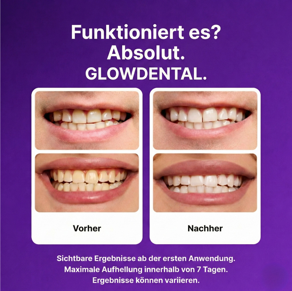GLOWDENTAL™ Anti-Gelbstich-Strips